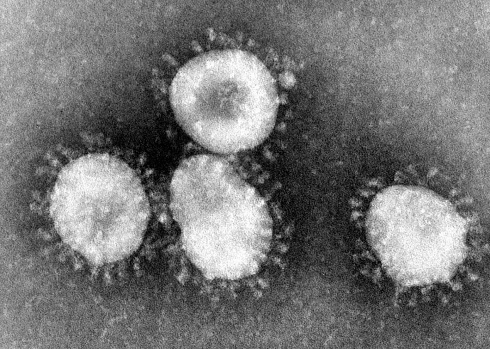 Coronavirus Wikipedia.jpg